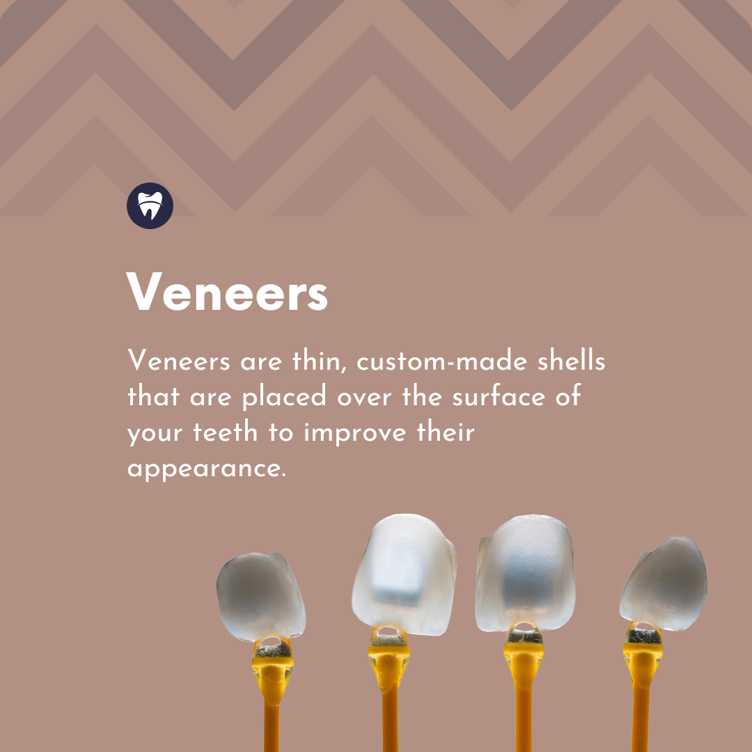 Are Veneers Bad for Your Teeth? Debunking Myths, Pros & Cons