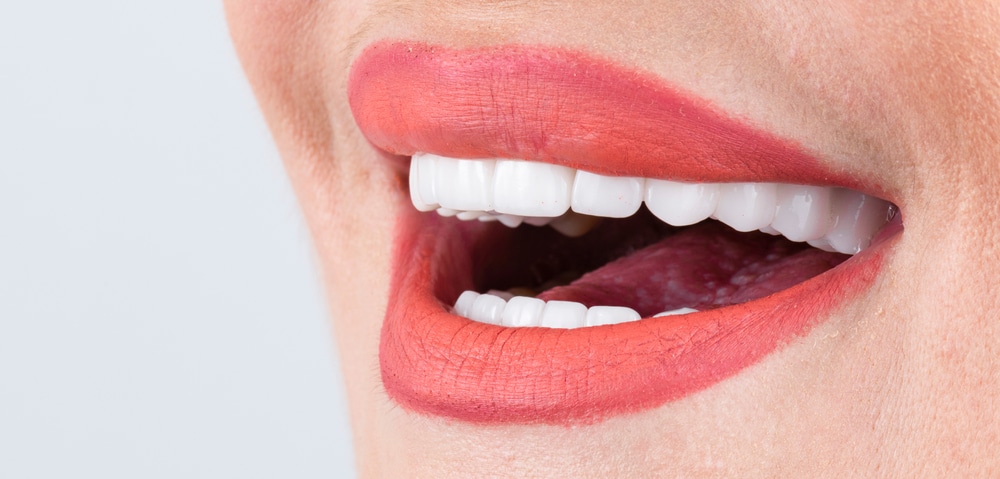 The Benefits of Porcelain Veneers Are They the Solution to Your Smile Issues