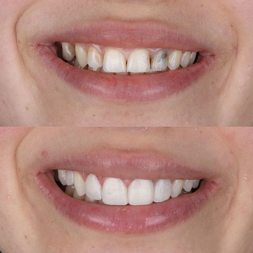 The difference between general and cosmetic dentistry explained — Smile Creative Ballarat