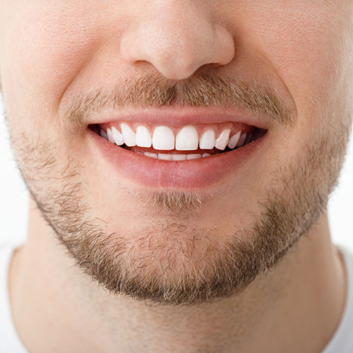 How to choose the right cosmetic dentist in Ballarat — Smile Creative guidance for patients