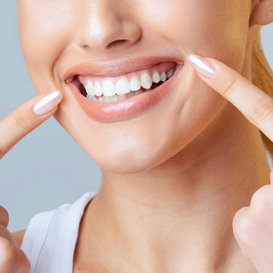 how long does teeth whitening last image
