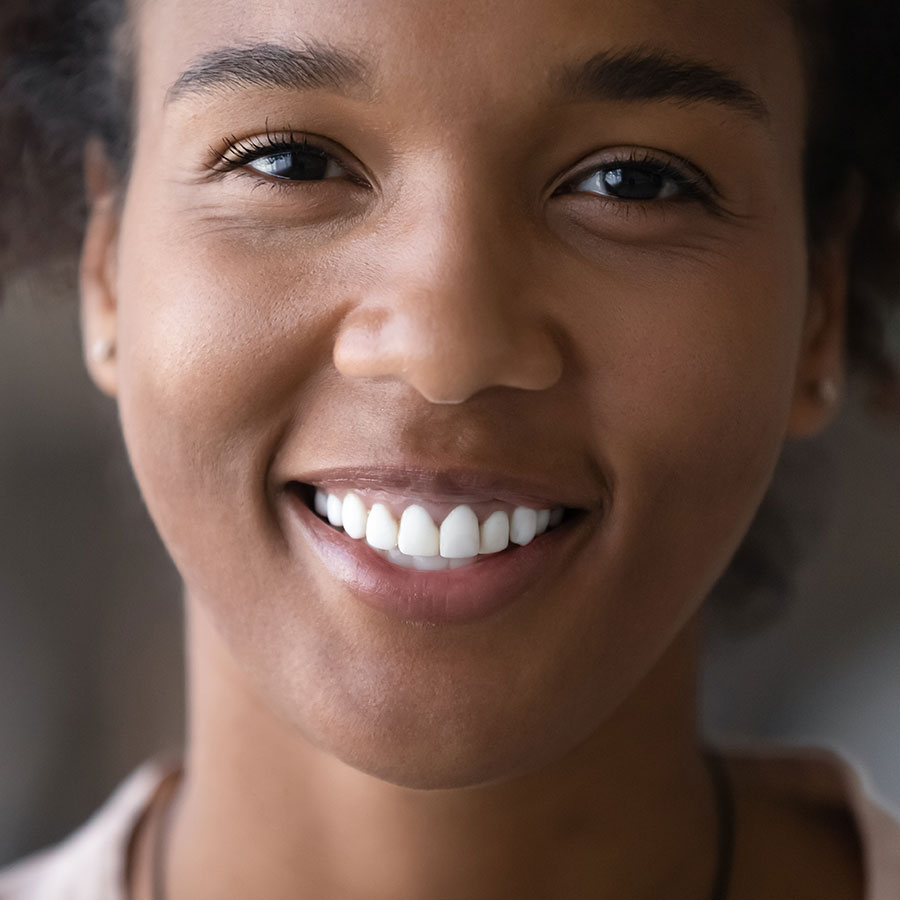 white for life teeth whitening ballarat image