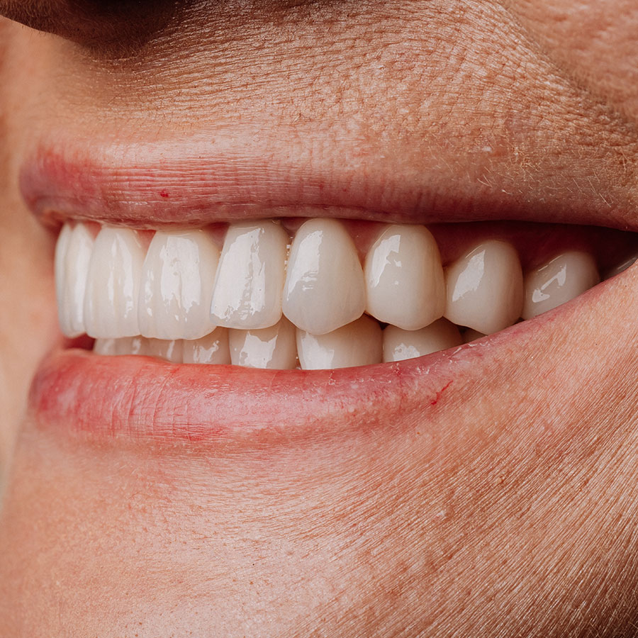 Dental review appointment checking an existing implant at Smile Creative Ballarat